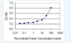 Novus Biologicals CD39L3/ENTPD3 Antibody (2A4), Novus Biologicals 100 &mu;g | Buy Online | Novus Biologicals&trade; | Fisher Scientific