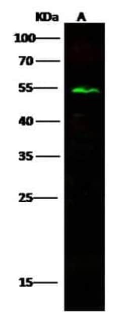 CD39L4/ENTPD5 Rabbit anti-Human, Clone: 64, Novus Biologicals:Antibodies:Primary