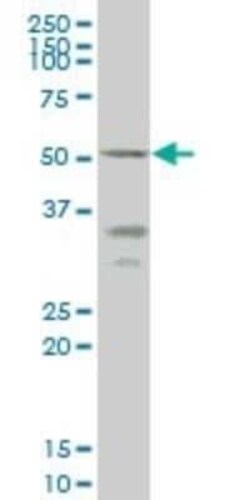 CD39L4/ENTPD5 Antibody (4A5), Novus Biologicals 0.1 mg | Buy Online | Novus Biologicals | Fisher Scientific