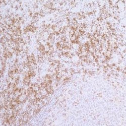 CD4 Antibody (BL-155-1C11), Novus Biologicals 100 &mu;L | Buy Online | Novus Biologicals | Fisher Scientific