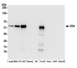 CD4 Antibody (BL-155-1C11), Novus Biologicals 100 &mu;L | Buy Online | Novus Biologicals | Fisher Scientific