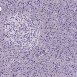 CD4 Antibody (CL0395), Novus Biologicals 25 &mu;L, Unconjugated:Antibodies,