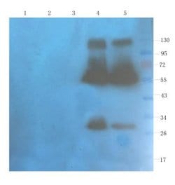 CD40 Ligand/TNFSF5 Antibody (hu5c8 (Ruplizumab)) - Azide and BSA Free, Novus Biologicals 0.025 mg | Buy Online | Novus Biologicals | Fisher Scientific