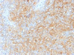 CD40/TNFRSF5 Antibody (C40/1605), Novus Biologicals 100&mu;g; Unlabeled:Antibodies,
