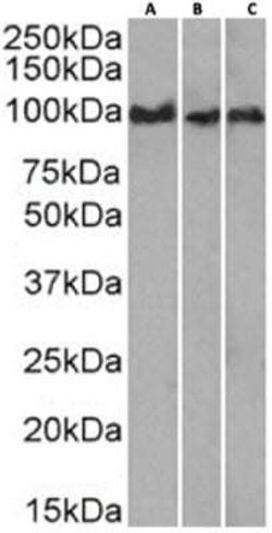 CD43/Sialophorin Rabbit anti-Human, Clone: 84-3C1, Novus Biologicals:Antibodies:Primary