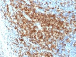 CD43/Sialophorin Rabbit anti-Human, Clone: SPN/2049R, Novus Biologicals:Antibodies:Primary