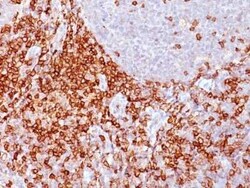 CD43/Sialophorin Antibody (Bra7G), Novus Biologicals 0.02mg; Unlabeled:Antibodies,