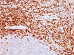 CD43/Sialophorin Antibody (DF-T1), Novus Biologicals 0.1mg; Unlabeled:Antibodies,