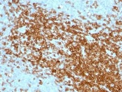 CD43/Sialophorin Antibody (SPN/1094), Novus Biologicals 0.1mg; Unlabeled:Antibodies,