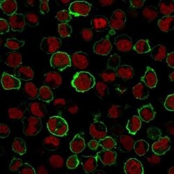 CD43/Sialophorin Antibody (SPN/1766R), Novus Biologicals:Antibodies:Primary