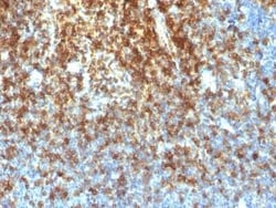 CD43/Sialophorin Antibody (SPN/1766R), Novus Biologicals:Antibodies:Primary