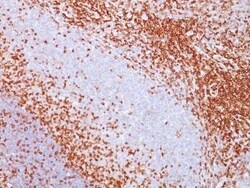 CD43/Sialophorin Antibody (SPN/839), Novus Biologicals:Antibodies:Primary