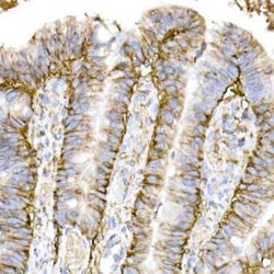 CD44 Rabbit anti-Human, Clone: 2V9T2, Novus Biologicals 100 &mu;g; Unconjugated:Antibodies,