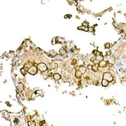 CD44 Rabbit anti-Human, Clone: 2V9T2, Novus Biologicals 100 &mu;g; Unconjugated:Antibodies,