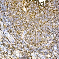 CD44 Rabbit anti-Human, Clone: 2V9T2, Novus Biologicals 100 &mu;g; Unconjugated:Antibodies,