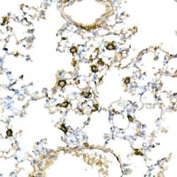 CD44 Rabbit anti-Human, Clone: 2V9T2, Novus Biologicals 100 &mu;g; Unconjugated:Antibodies,