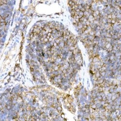 CD44 Rabbit anti-Human, Clone: 2V9T2, Novus Biologicals 100 &mu;g; Unconjugated:Antibodies,