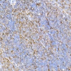 CD44 Rabbit anti-Human, Clone: 2V9T2, Novus Biologicals 100 &mu;g; Unconjugated:Antibodies,