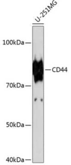 CD44 Rabbit anti-Human, Clone: 2V9T2, Novus Biologicals 100 &mu;g; Unconjugated:Antibodies,