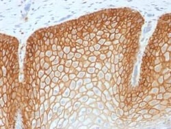 CD44 Antibody (CD44v4/1700R) - variant 4, Novus Biologicals:Antibodies:Primary