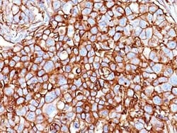 CD44 Antibody (HCAM/918), Novus Biologicals 0.1mg; Unlabeled:Antibodies,