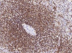 CD45 Rabbit anti-Human, Clone: 101, Novus Biologicals:Antibodies:Primary