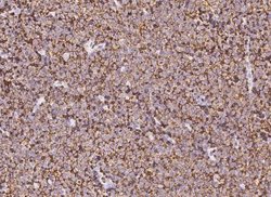 CD45 Rabbit anti-Human, Clone: 101, Novus Biologicals:Antibodies:Primary