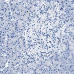 CD46 Antibody, Novus Biologicals 0.1 mL | Buy Online | Novus Biologicals | Fisher Scientific
