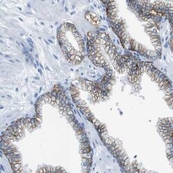 CD46 Antibody, Novus Biologicals 0.1 mL | Buy Online | Novus Biologicals | Fisher Scientific