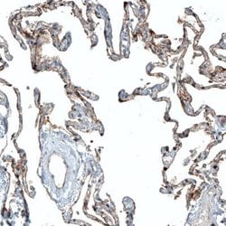 CD47 Antibody (CL6913), Novus Biologicals 25 &mu;L; CD47 Antibody; Unconjugated:Antibodies,