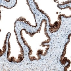 CD47 Antibody (CL6913), Novus Biologicals 25 &mu;L; CD47 Antibody; Unconjugated:Antibodies,