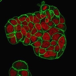 CD47 Antibody (IAP/964 + B6H12.2), Novus Biologicals:Antibodies:Primary