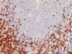 CD5 Antibody (C5/473), Novus Biologicals 0.1 mg; Unconjugated:Anticuerpos