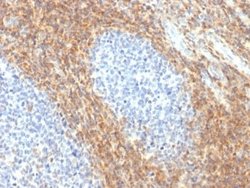 CD52 Rabbit anti-Human, Monkey, Clone: CD52/2276R, Novus Biologicals:Antibodies:Primary
