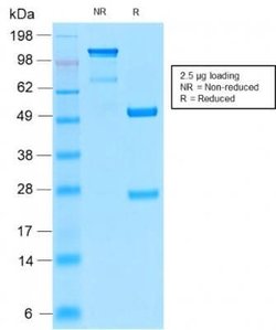 CD52 Rabbit anti-Human, Monkey, Clone: CD52/2276R, Novus Biologicals:Antibodies:Primary