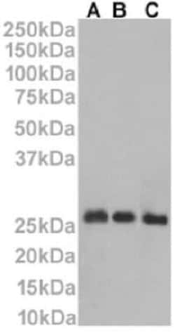 CD53 Rabbit anti-Human, Clone: HD77, Novus Biologicals 0.025 mg | Buy Online | Novus Biologicals | Fisher Scientific