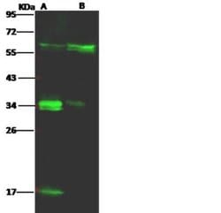 CD58/LFA-3 Rabbit anti-Human, Clone: 85, Novus Biologicals 50 &mu;g; Unconjugated:Antibodies,