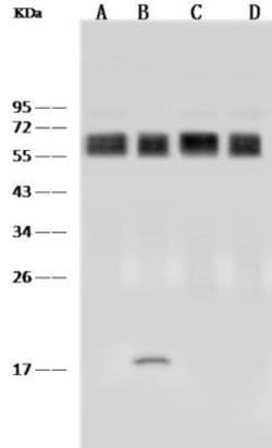 CD58/LFA-3 Rabbit anti-Human, Clone: 186, Novus Biologicals 100 &mu;g;