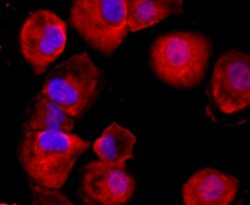 CD59 Rabbit anti-Human, Mouse, Clone: JM10-71, Novus Biologicals 100&mu;L:Antibodies,