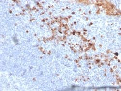 CD5L, Mouse anti-Human, Clone: CD5L/2991, Novus Biologicals 100 ug; Unconjugated:Antibodies,