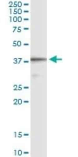 CD5L Antibody (1C8), Novus Biologicals 0.1 mg | Buy Online | Novus Biologicals | Fisher Scientific