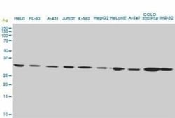 CD5L Antibody (1C8), Novus Biologicals 0.1 mg | Buy Online | Novus Biologicals | Fisher Scientific