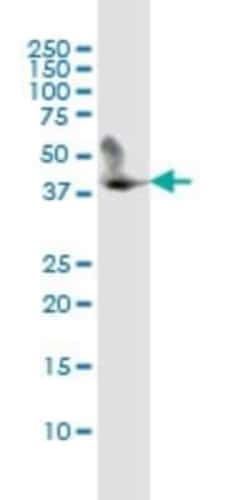 CD5L Antibody (1C8), Novus Biologicals 0.1 mg | Buy Online | Novus Biologicals | Fisher Scientific