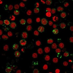 CD6 Antibody (SPV-L14), Novus Biologicals 0.02mg; Unlabeled:Antibodies,
