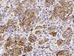 CD63 Rabbit anti-Human, Clone: 1, Novus Biologicals 50 &mu;g; Unconjugated:Antibodies,