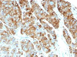 CD63 Antibody (LAMP3/968), Novus Biologicals:Antibodies:Primary Antibodies