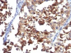 CD63 Antibody (LAMP3/968), Novus Biologicals:Antibodies:Primary Antibodies