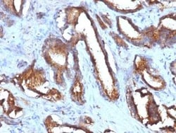 CD63 Antibody (NKI/C3 + LAMP3/968), Novus Biologicals:Antibodies:Primary