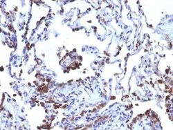 CD63 Antibody (NKI/C3 + LAMP3/968), Novus Biologicals:Antibodies:Primary