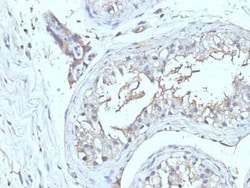 CD63 Antibody (NKI/C3 + LAMP3/968), Novus Biologicals:Antibodies:Primary
